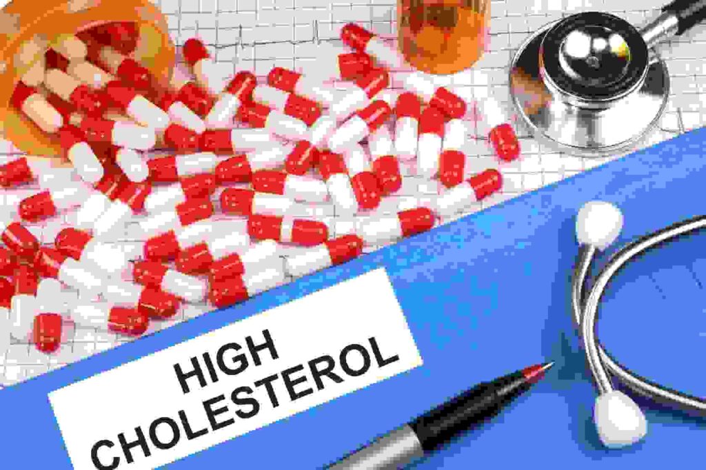 high cholesterol