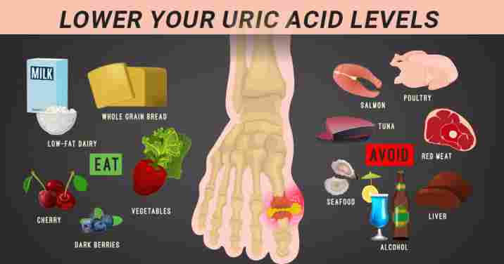 avoid foods for Uric Acids